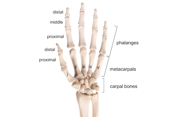 Metacarpal fractures